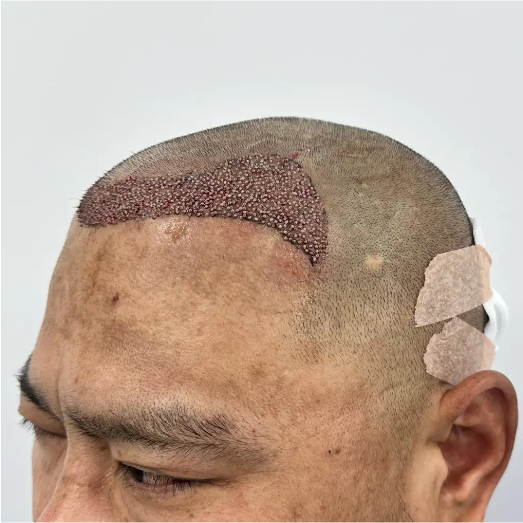D6