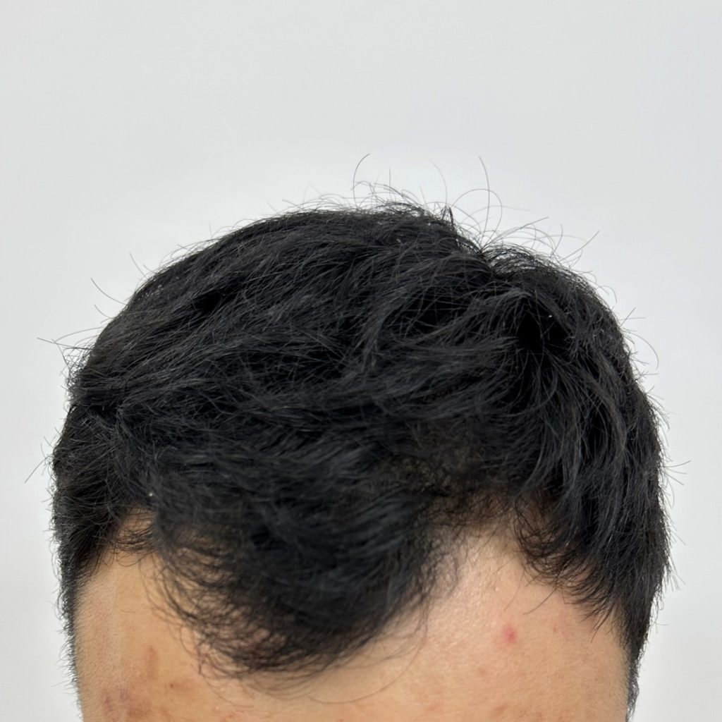O1