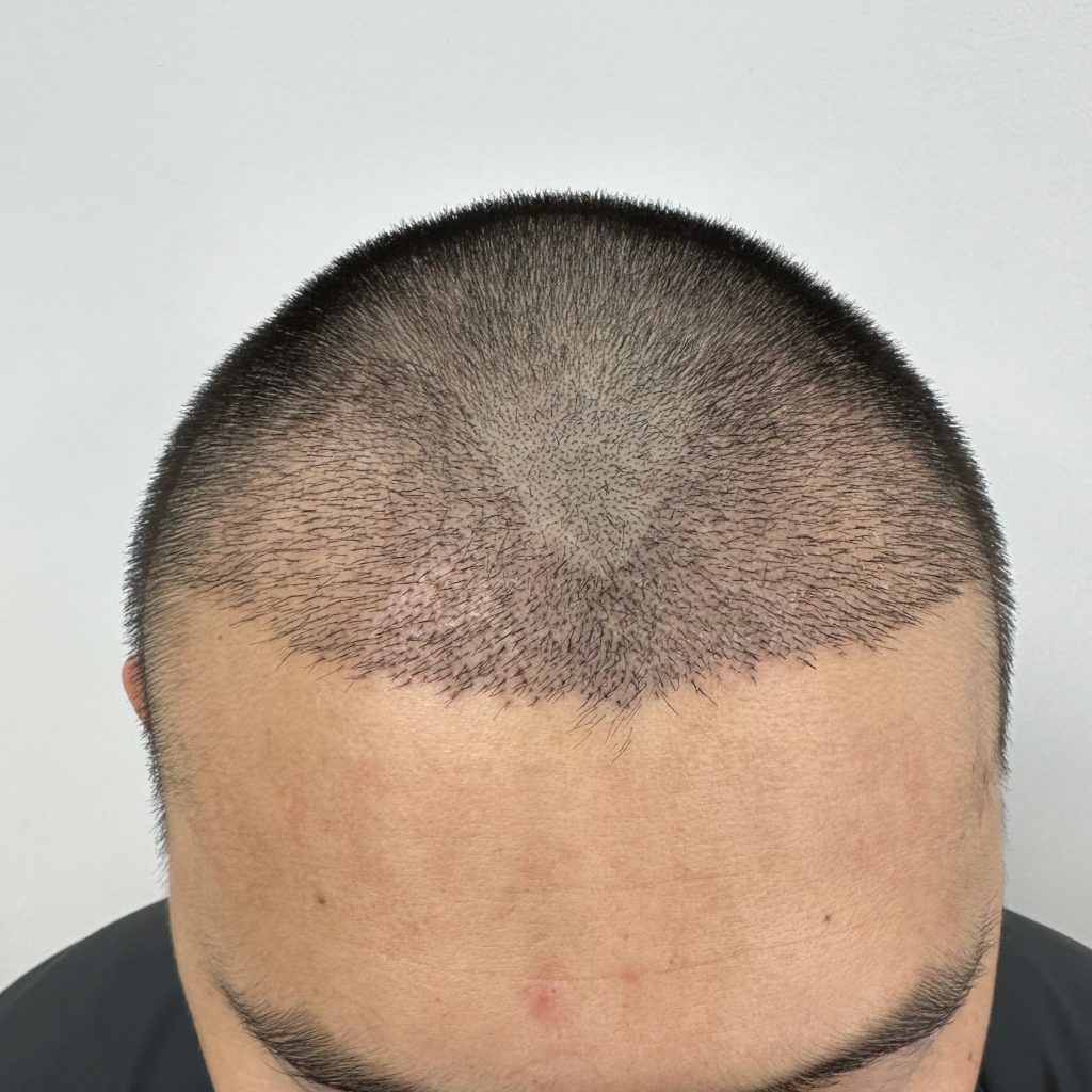 I4