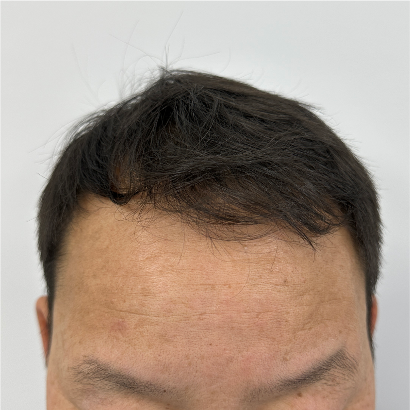 kk1