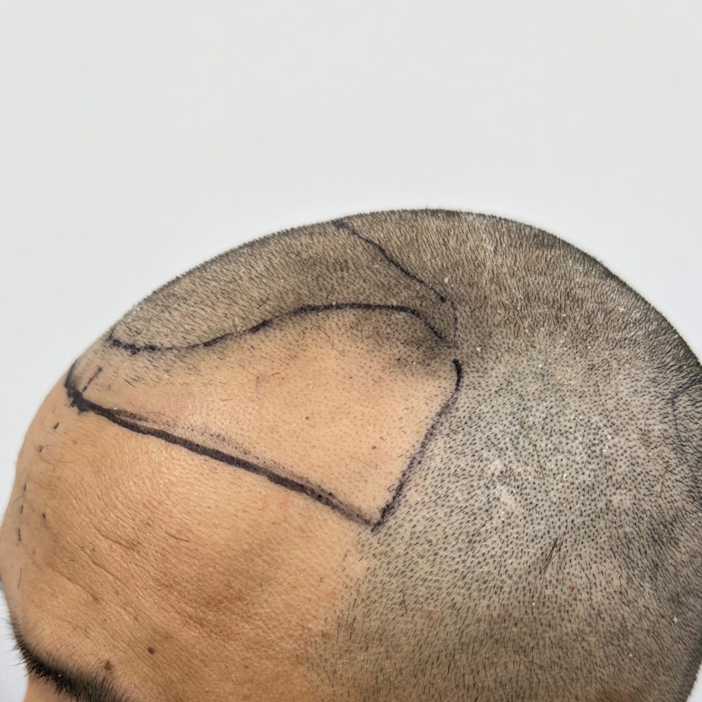 П4