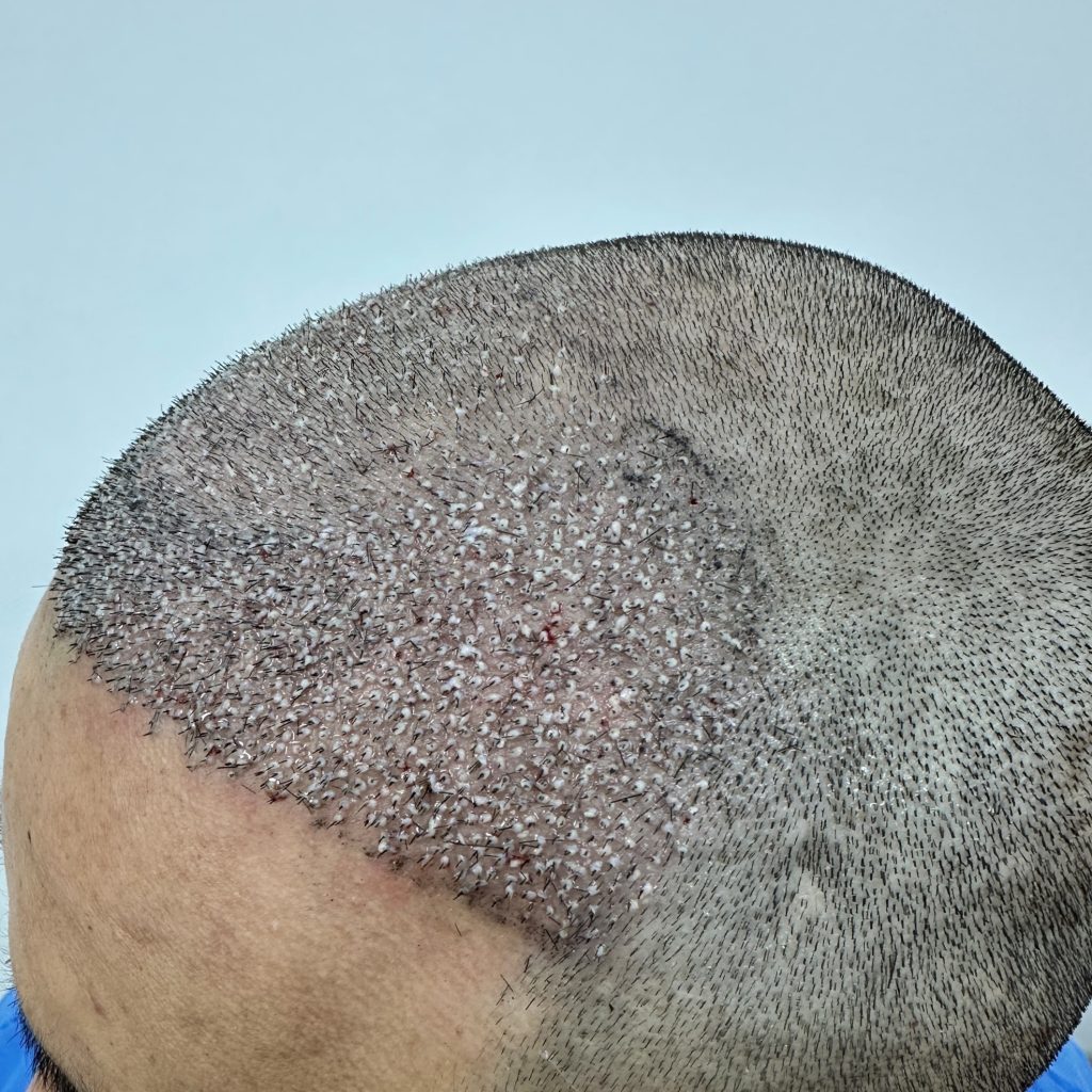 П6