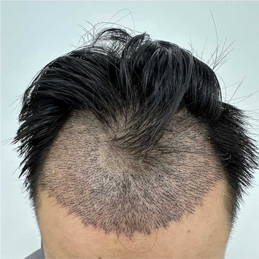 Picture1